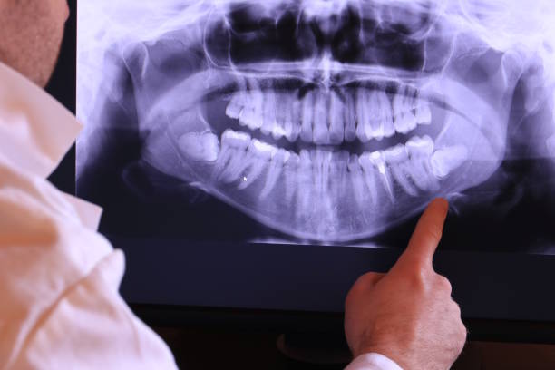 Best Emergency Gum Pain Relief  in Pineville, LA